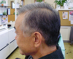 �����s�����X�u���a�ٗ��e���v�̔����ڂ����{�p��