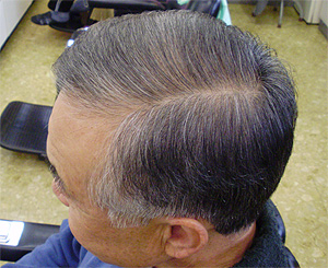 �����s�����X�u���a�ٗ��e���v�̔����ڂ����{�p��